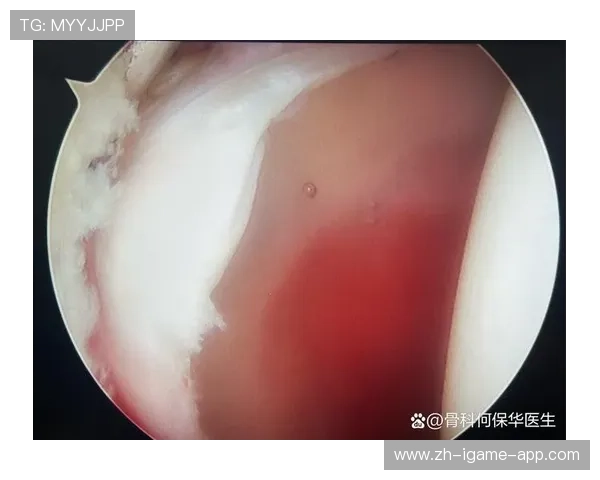 凯斯勒左肩关节盂唇撕裂，本赛季报销！内线低迷让球队头疼